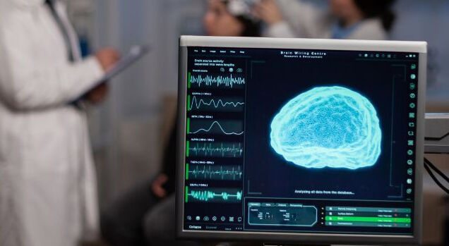 Monitor exibindo análise de atividade cerebral